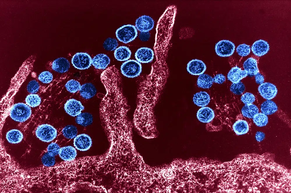 Can Squirrels Carry Hantavirus