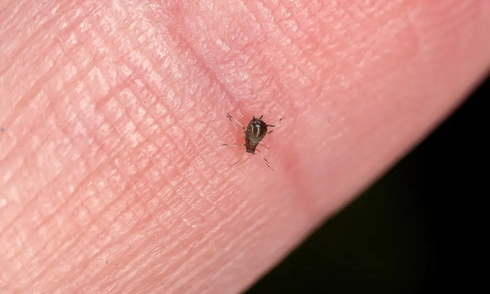 Can Aphids Can Skin Irritation 1