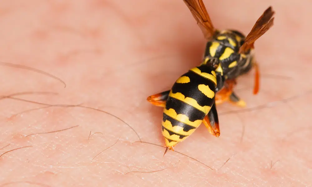 Are Wasp Stings Dangerous